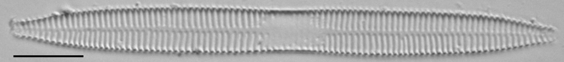 Ulnaria contracta LM7