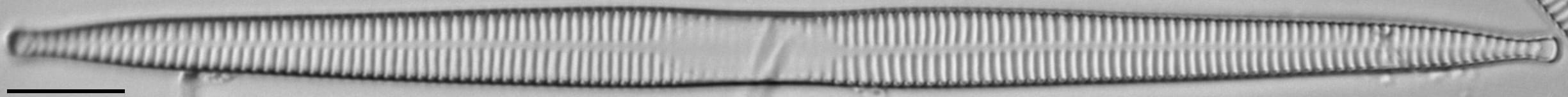 Ulnaria contracta LM6