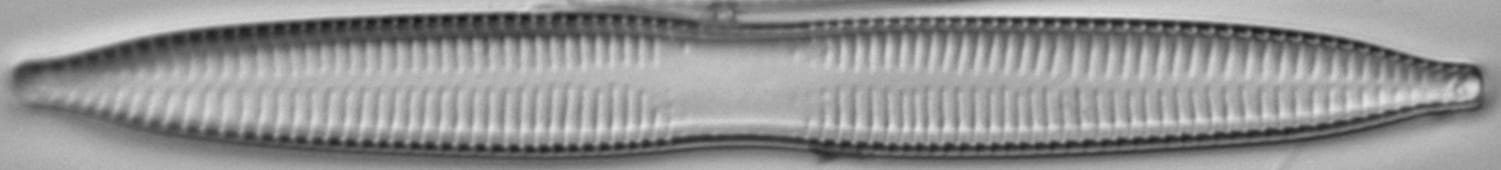 Ulnaria contracta LM5