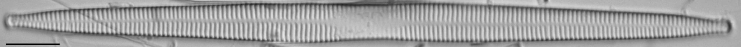 Ulnaria contracta LM4