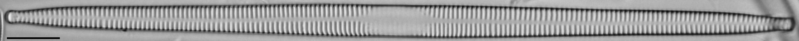 Ulnaria contracta LM2