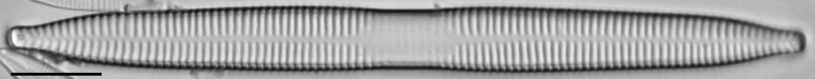 Ulnaria contracta LM1