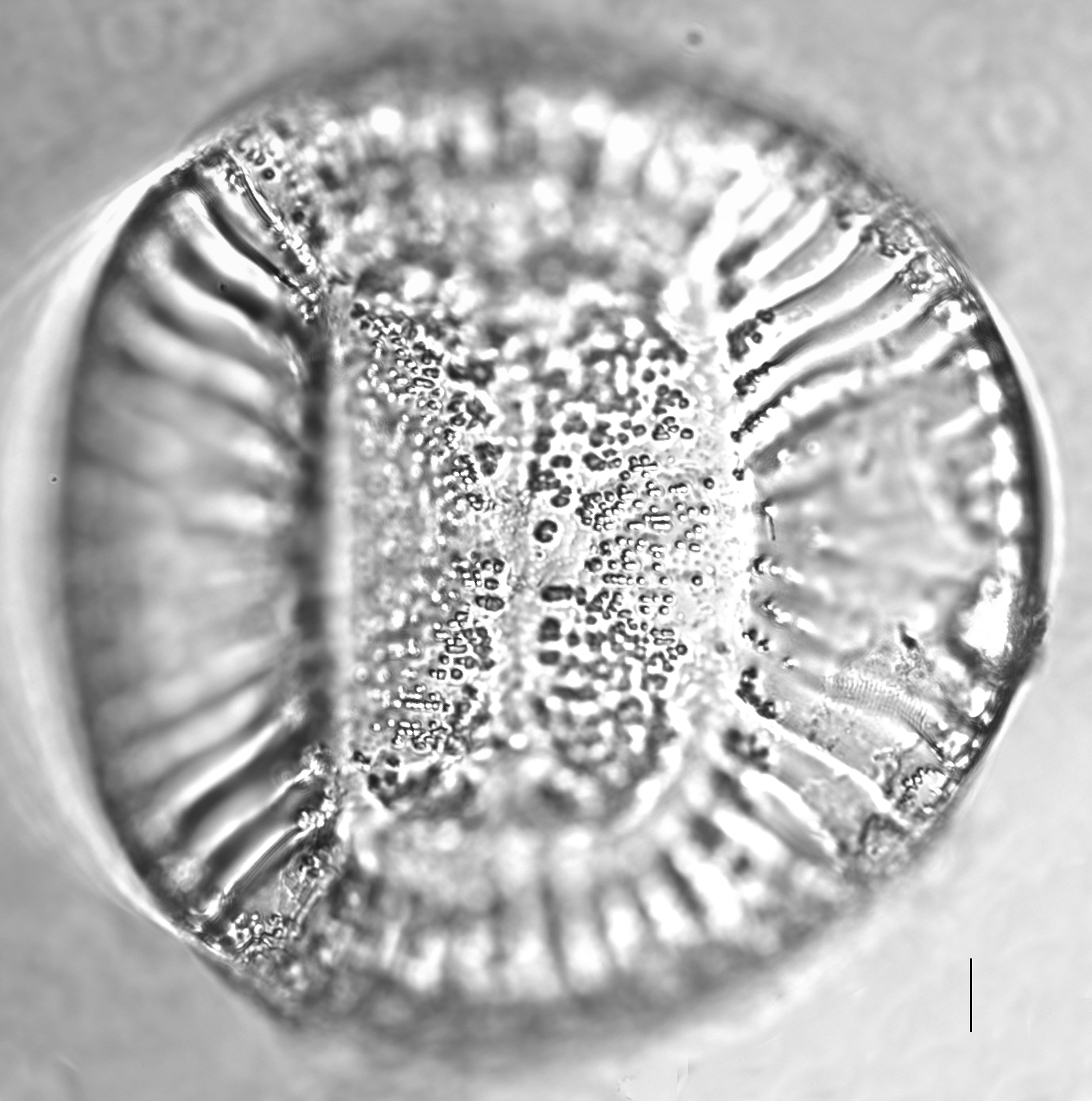 Campylodiscus clypeus_LM7