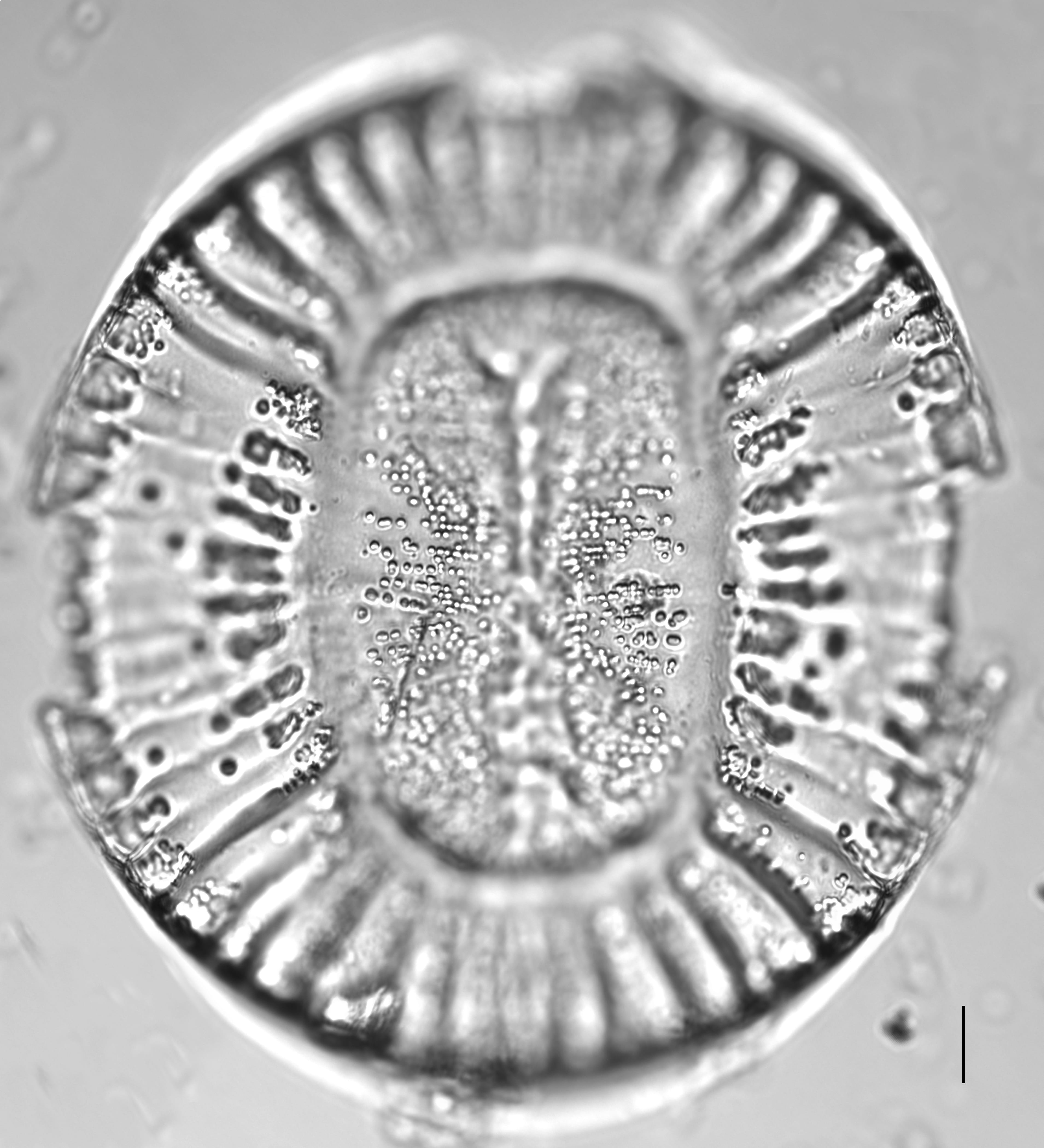 Campylodiscus clypeus_LM6