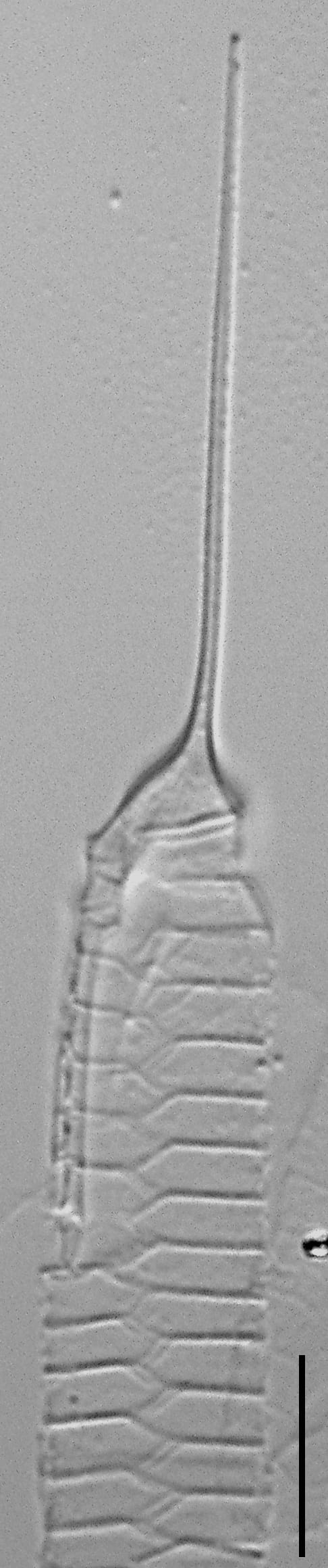 Urosolenia Eriensis Lm14