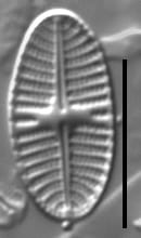 Platessa stewartii LM4