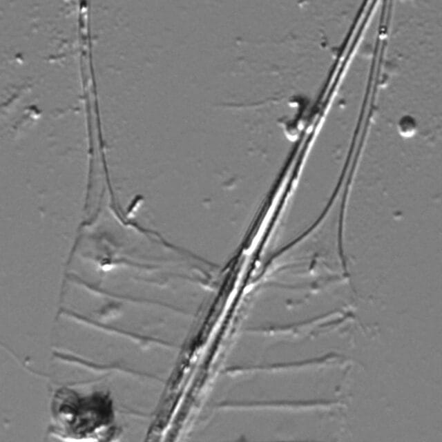 Acanthoceras zachariasii LM1