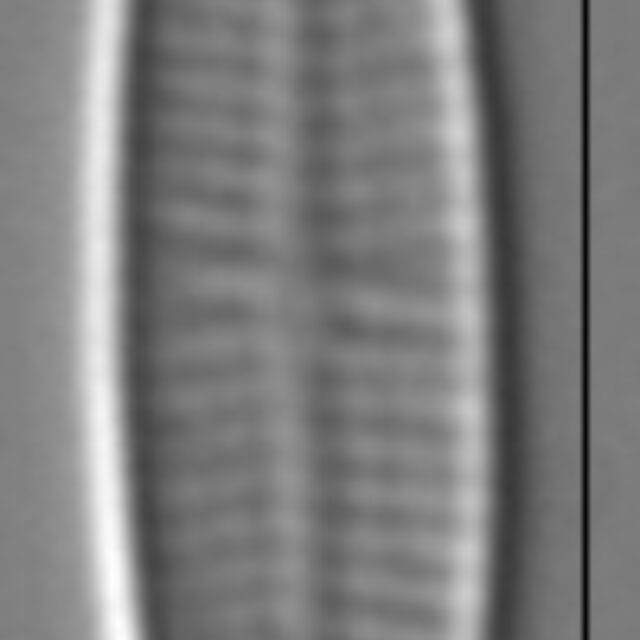 Achnanthidium minutissimum LM4