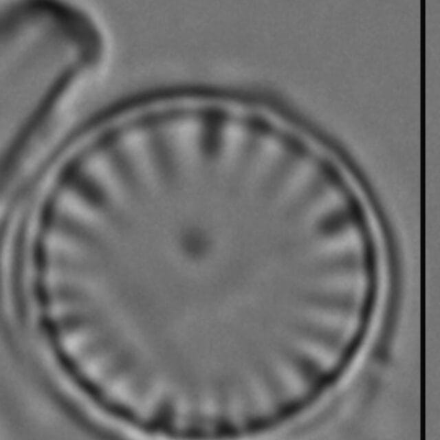 Cyclotella atomus LM2