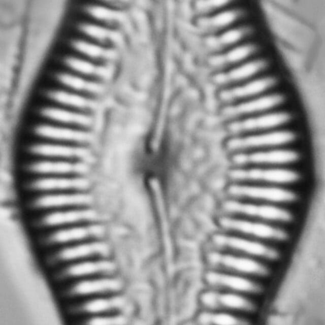 Pinnularia turgidula LM7