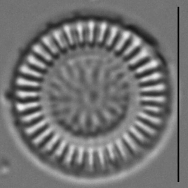 Discostella stelligera LM5