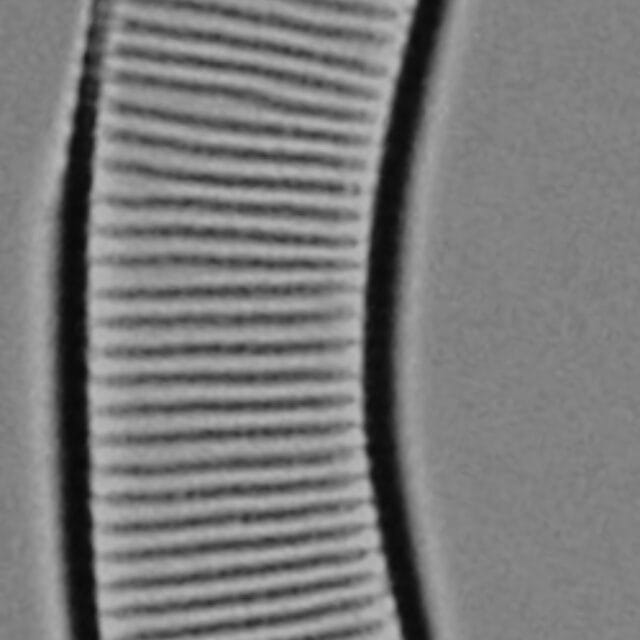 Eunotia pseudoparallela LM7