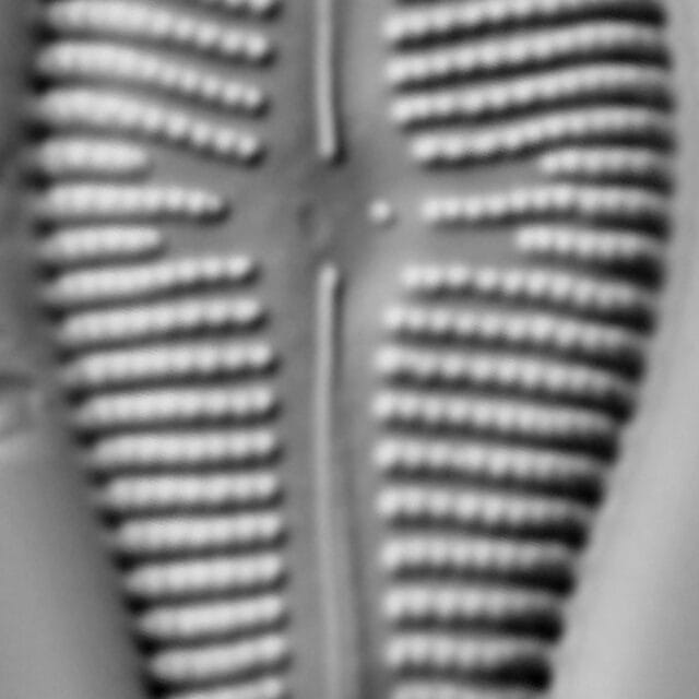 Gomphonema turgidum LM3