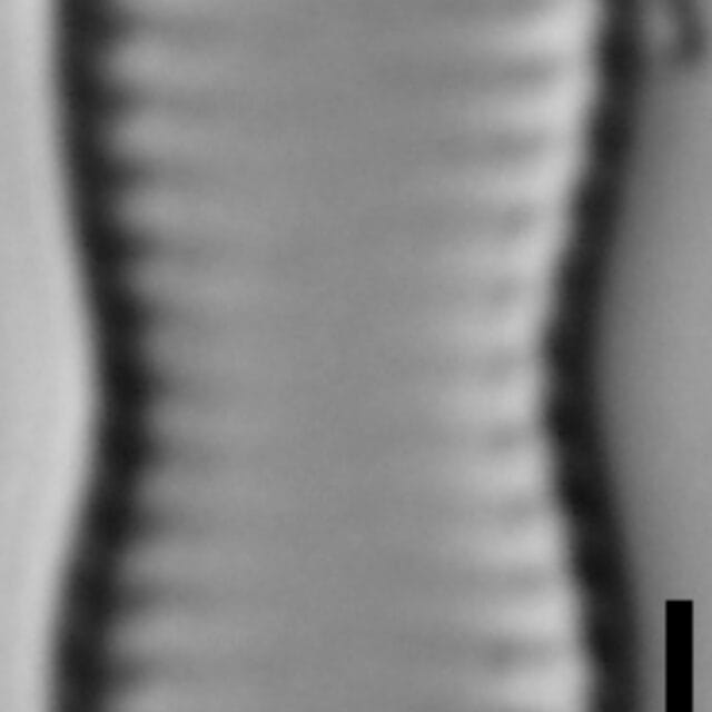 Pseudostaurosira_parasitica_var_subconstricta_LM2