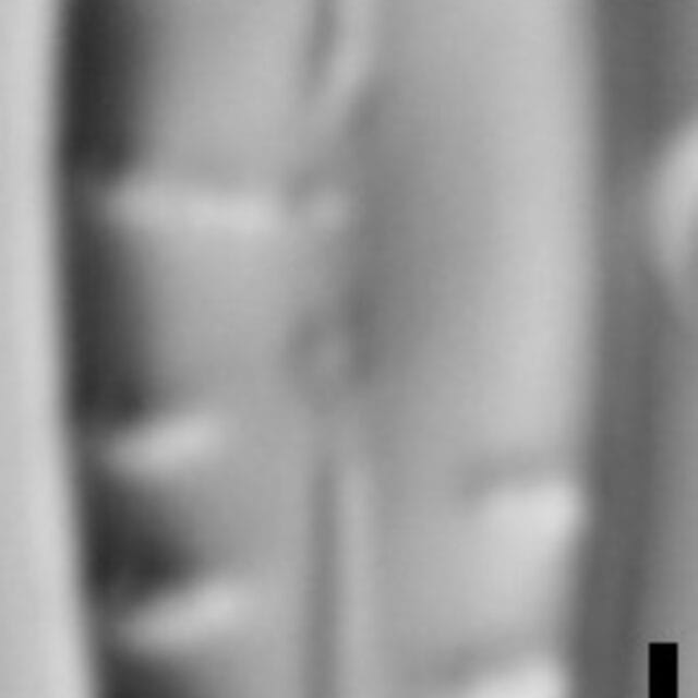 Gomphonema variostratum LM5