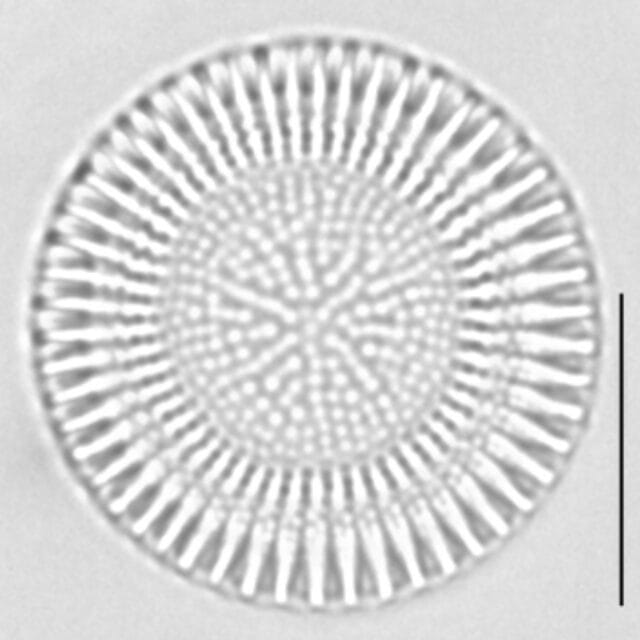 Cyclostephanos dubius LM5