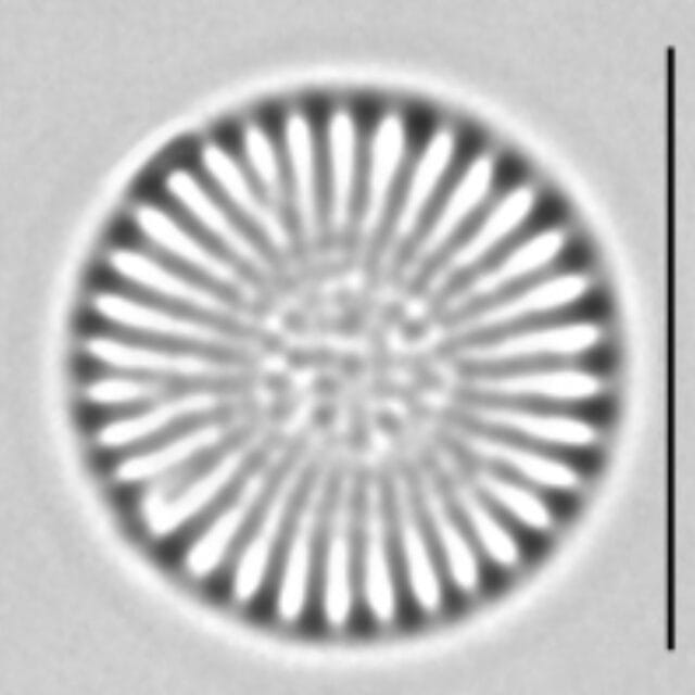Cyclostephanos dubius LM1