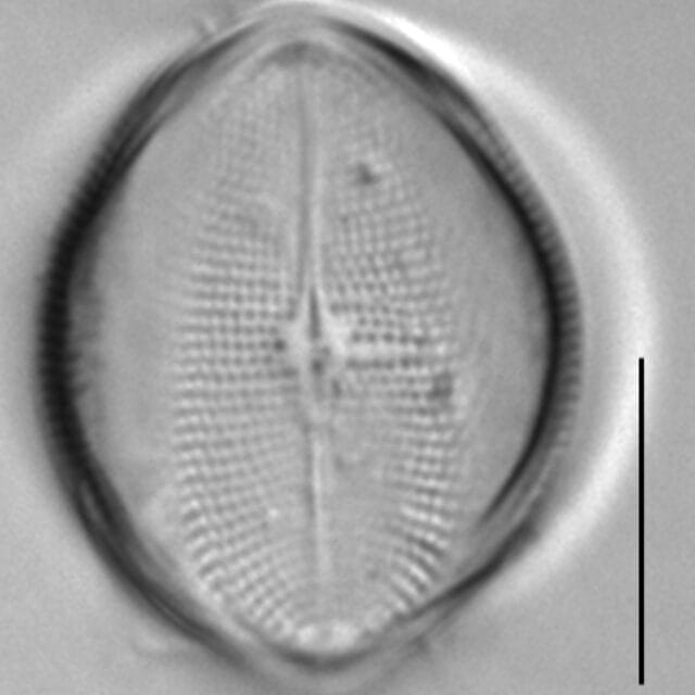 Cocconeis pediculus LM2