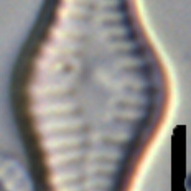 Tabellaria flocculosa LM3