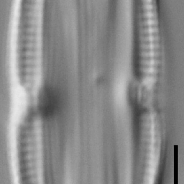 Halamphora bicapitata LM7