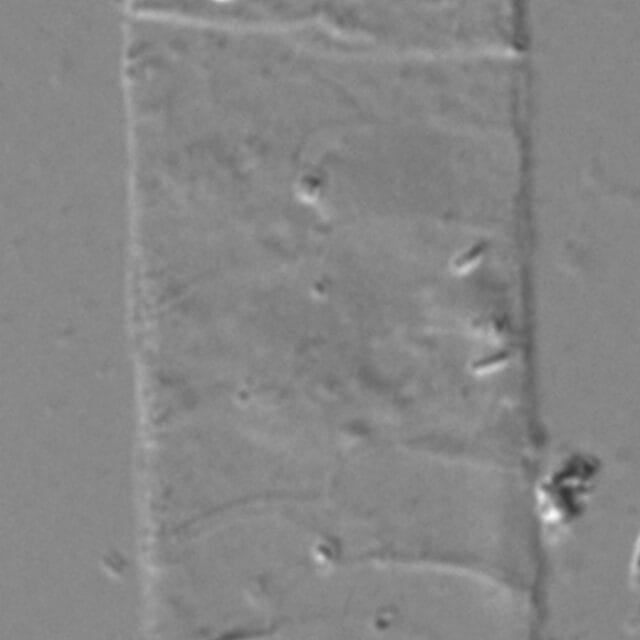 Acanthoceras zachariasii LM6