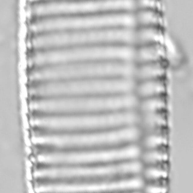 Achnanthes brevipes LM5