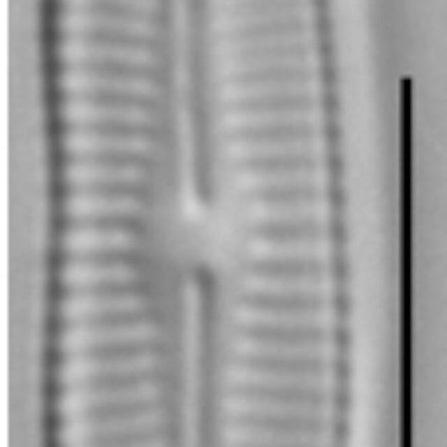 Achnanthidium crassum LM2