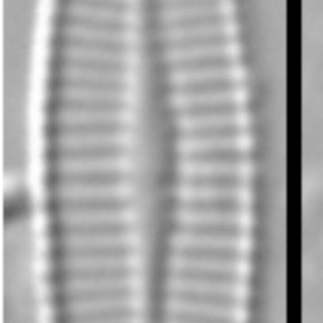 Achnanthidium crassum LM6