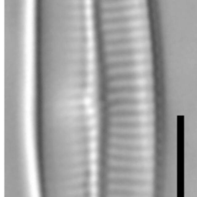 Achnanthidium crassum LM5