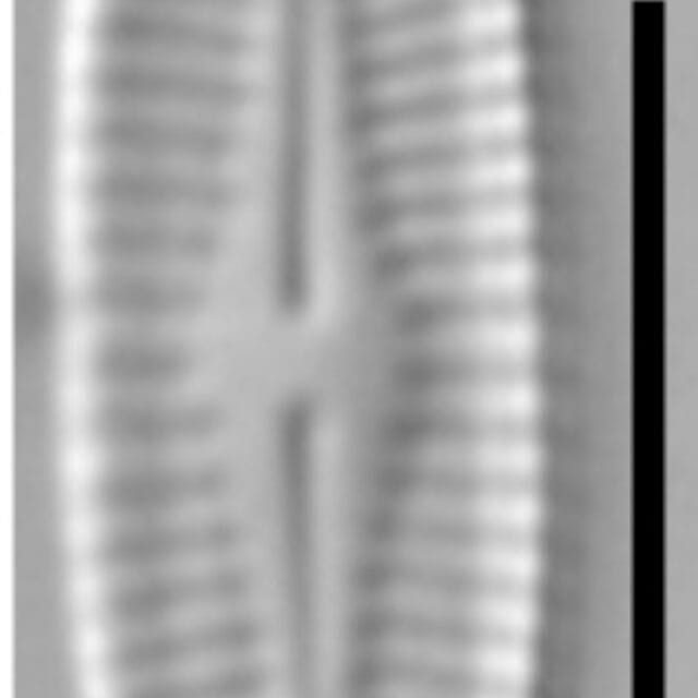 Achnanthidium crassum LM3