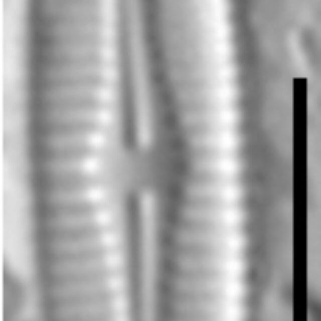 Achnanthidium crassum LM4