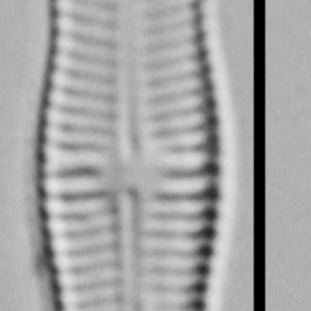 Achnanthidium Rosenstockii Vt10089 A 010418 11 C