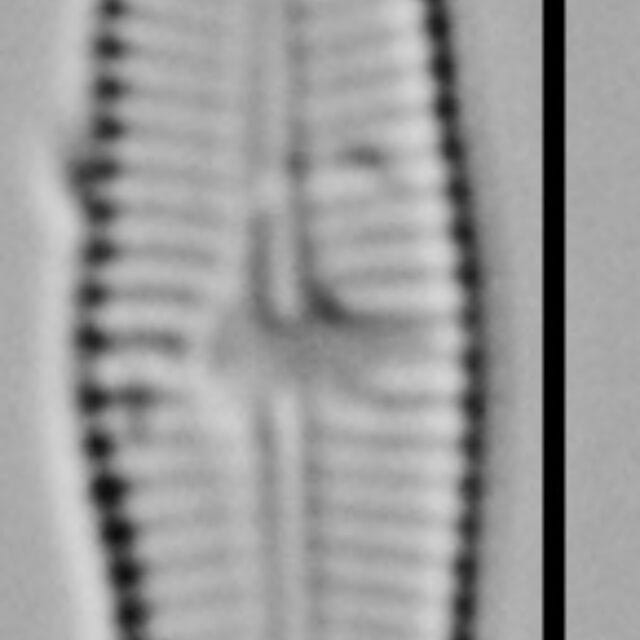 Achnanthidium Rosenstockii Vt10093 A 012618 02 C