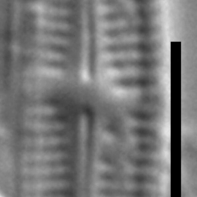 Achnanthidium thienimannii LM2