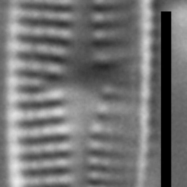 Achnanthidium thienimannii LM3