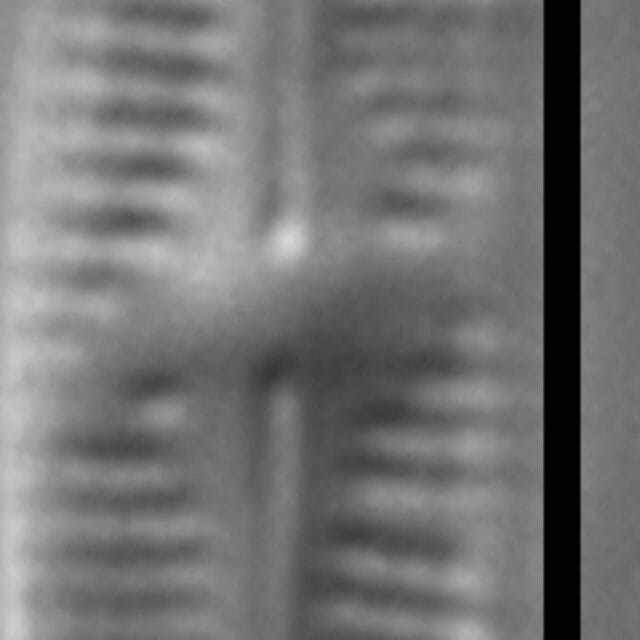 Achnanthidium thienimannii LM4