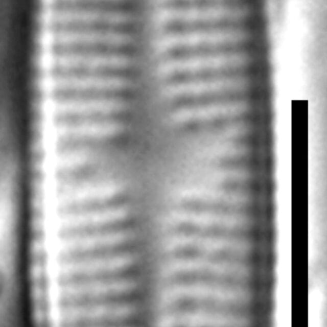 Achnanthidium thienimannii LM5