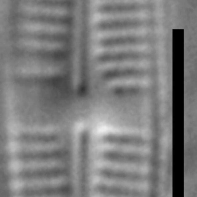Achnanthidium thienimannii LM7