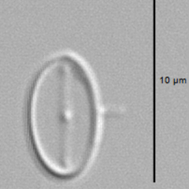 Amicula vermiculata LM1