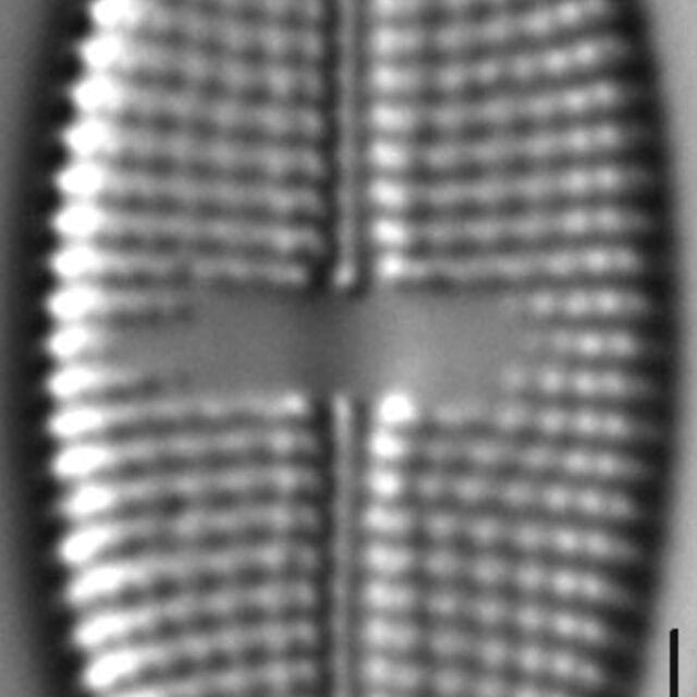 Aneumastus stroesei LM7