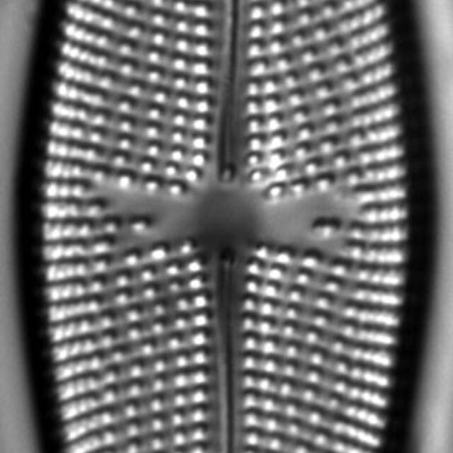 Aneumastustusculus 1