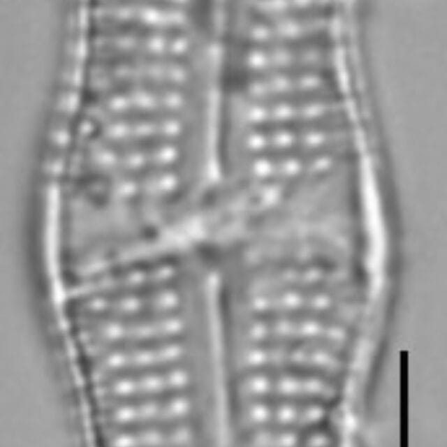 Achnanthes tumescens LM7