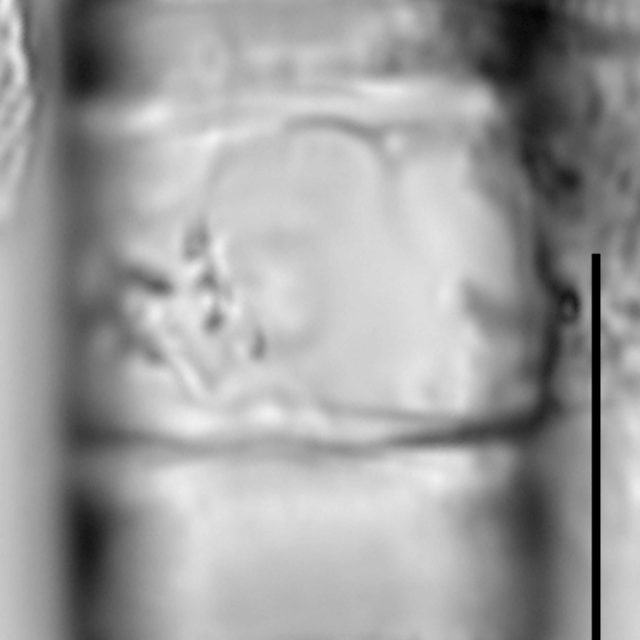 Aulacoseira pseudoamericana LM1