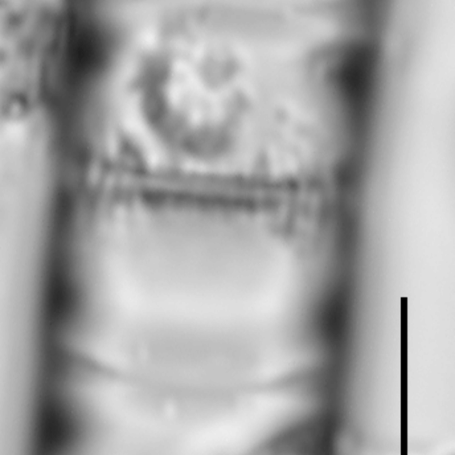 Aulacoseira pseudoamericana LM6