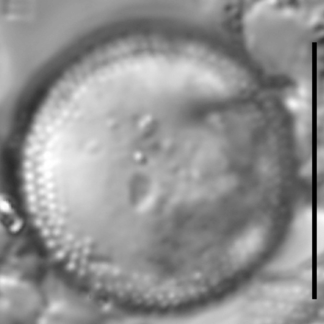 Aulacoseira pseudoamericana LM7