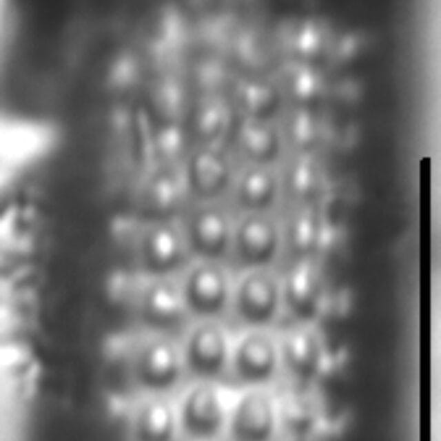 Aulacoseira canadensis LM4