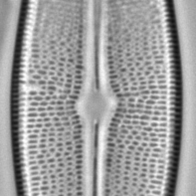Brachysira serians LM3
