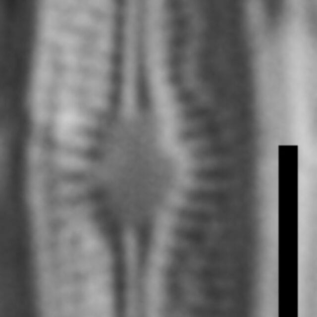 Brachysira subtile LM7