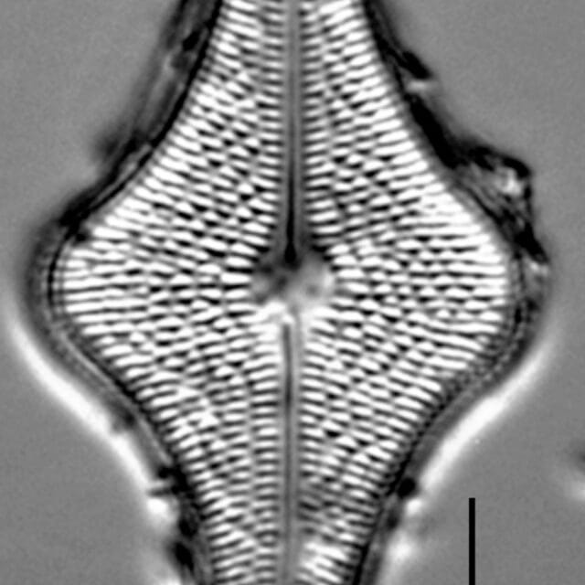 Brachysira follis LM6