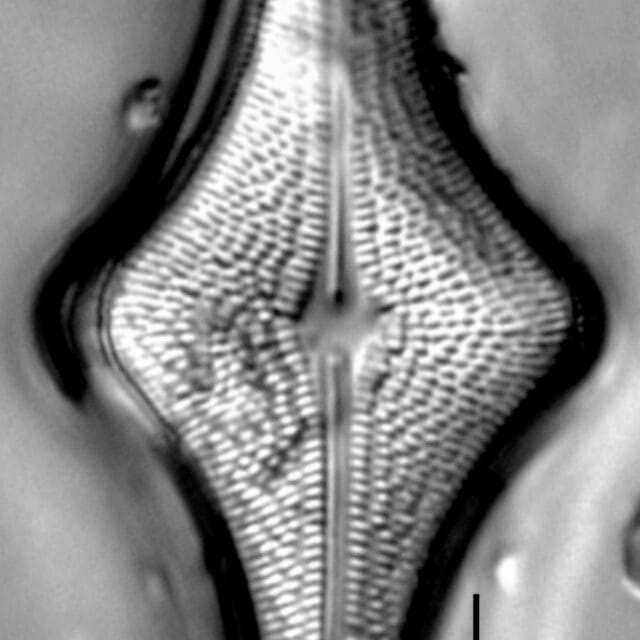 Brachysira follis LM3